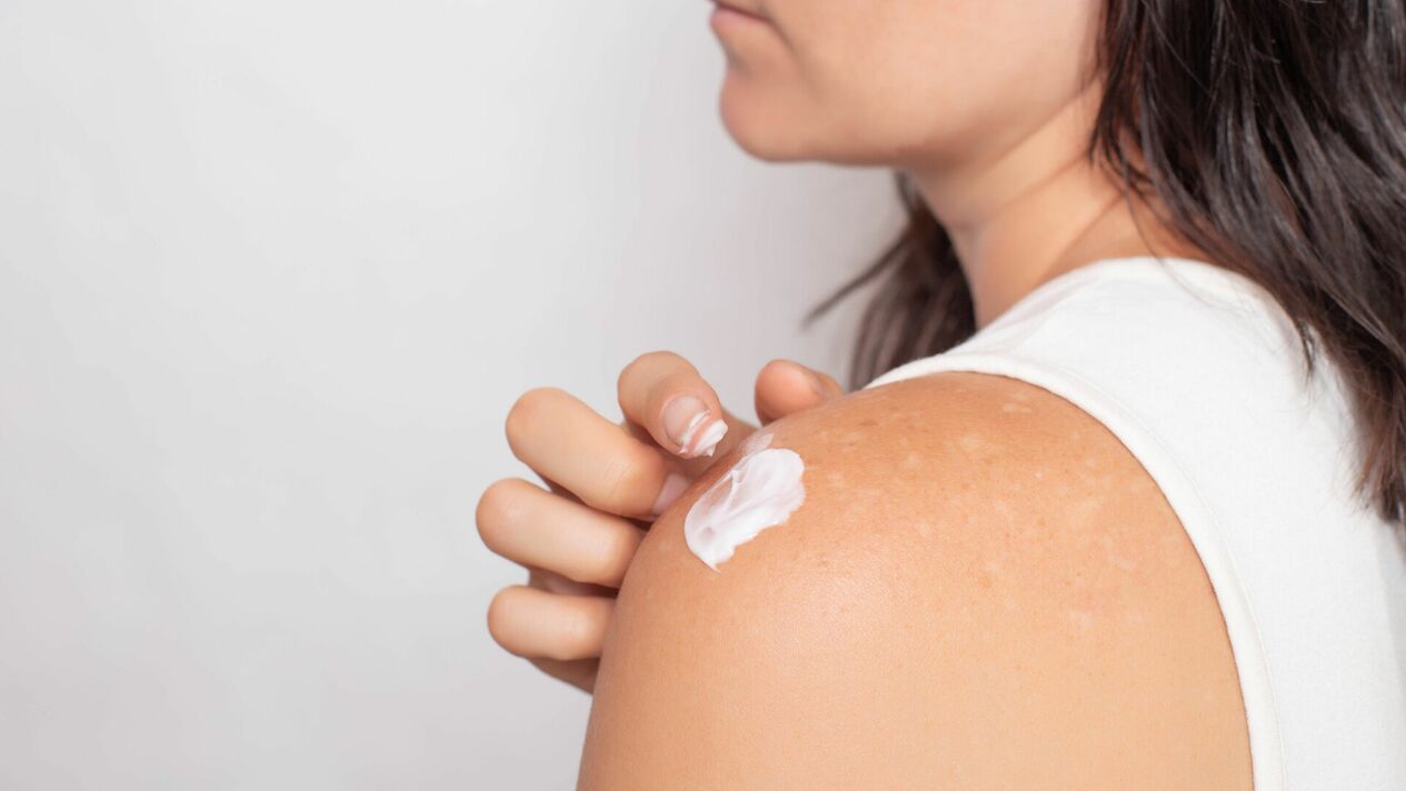 Aplicação de gel hondroína da dor na articulação do ombro