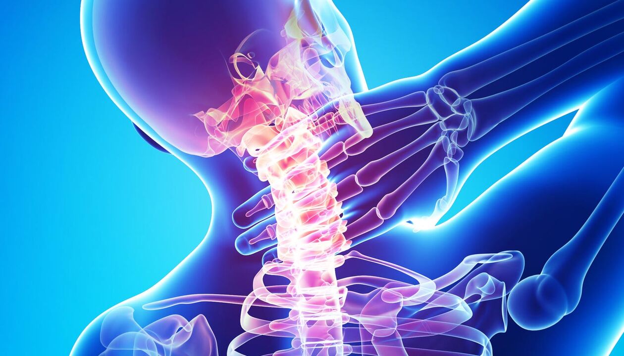 dor no pescoço devido à osteocondrose