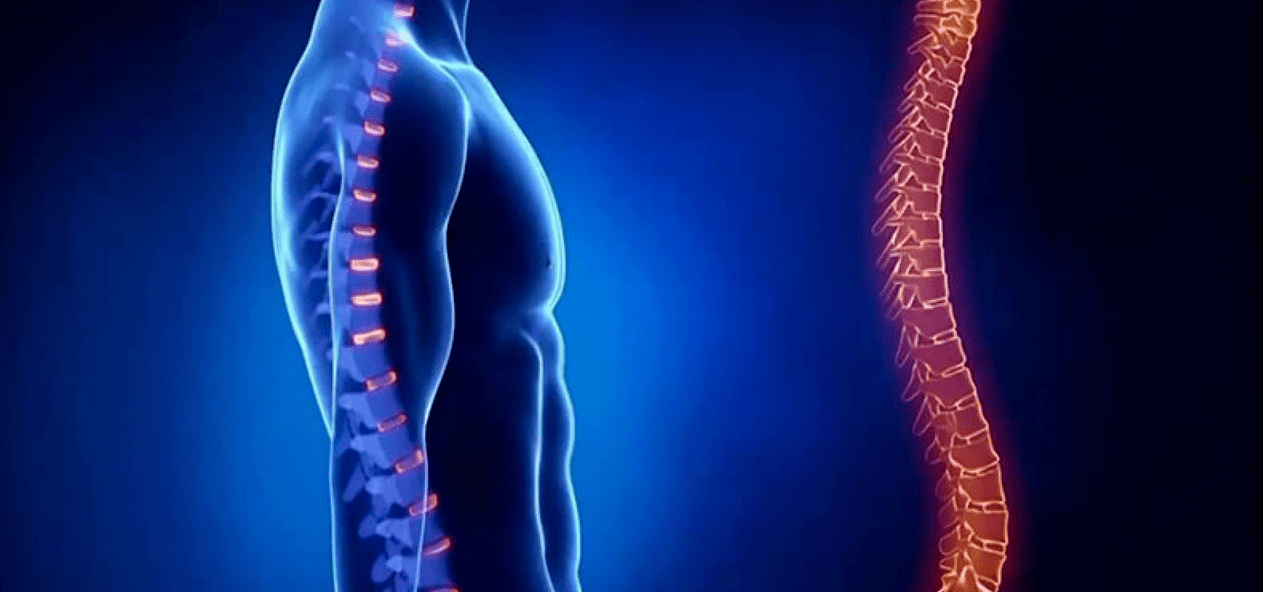 lesões espinhais devido à osteocondrose